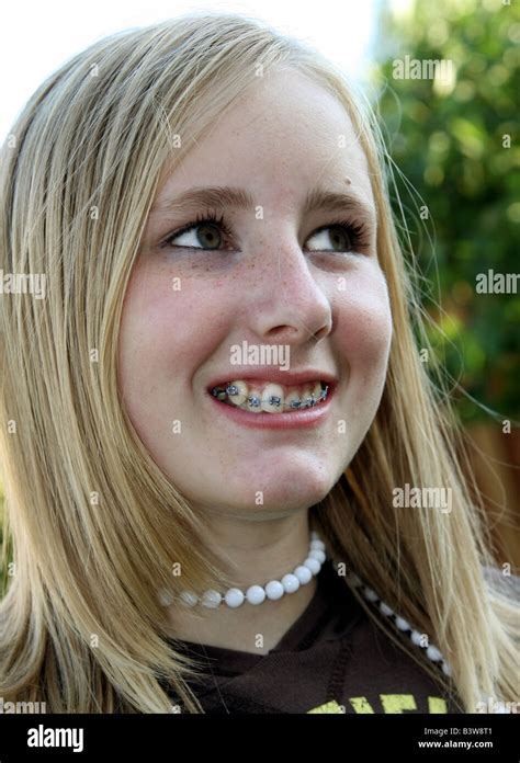 999 Young Blonde Girl Braces Stock Photos